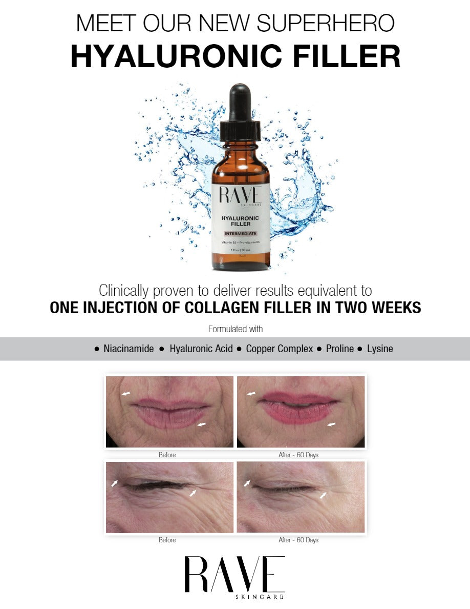 Hyaluronic Filler